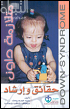 متلازمة داون : حقائق وإرشادات